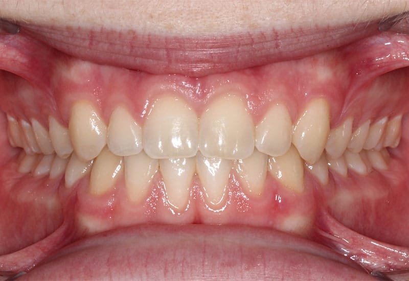 Spacing-after Spacing-after