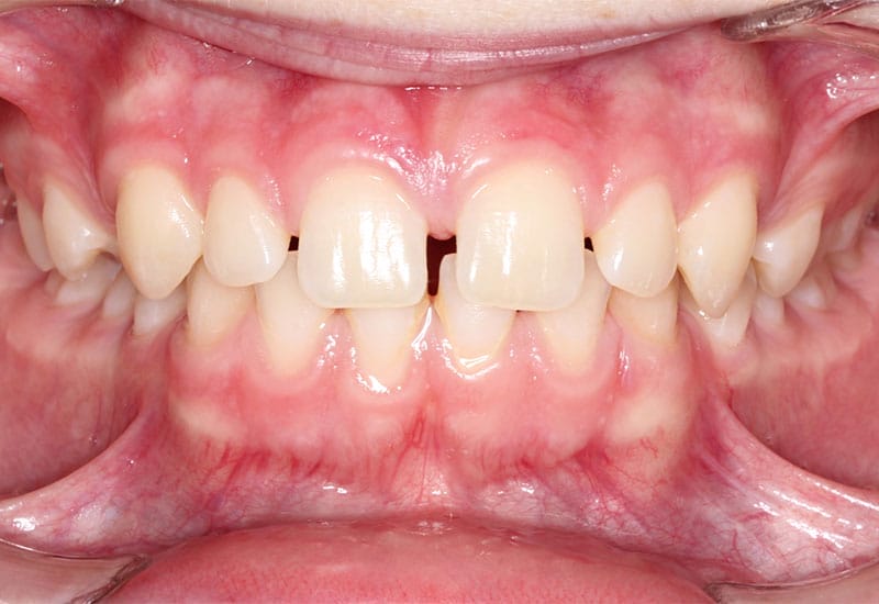 Spacing-before Spacing-before